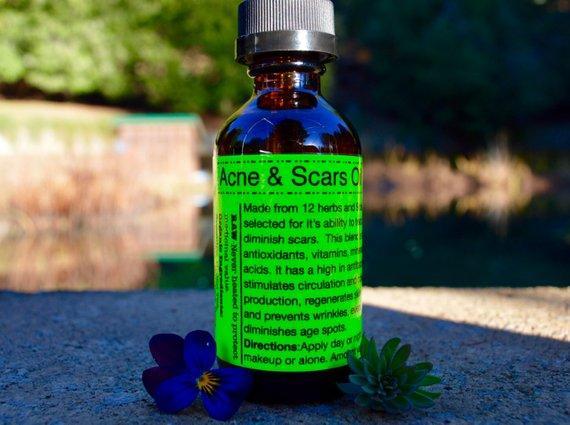 Organic Sensitive Skin Acne & Scars Oil Vegan